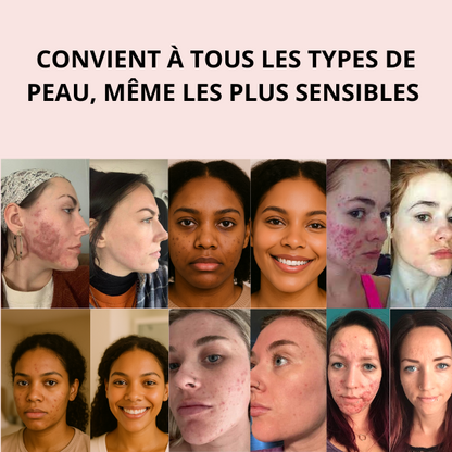 Pads Anti-Imperfections au Curcuma et Acide Kojique - soin complet 6en1