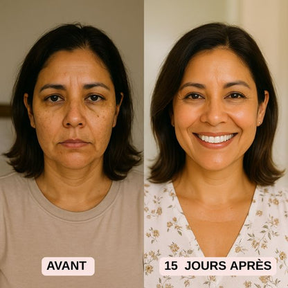 Pads Anti-Imperfections au Curcuma et Acide Kojique - soin complet 6en1