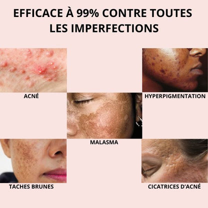 Pads Anti-Imperfections au Curcuma et Acide Kojique - soin complet 6en1