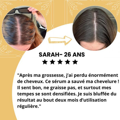 Huile de croissance pour cheveux