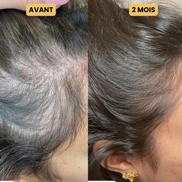 Huile de croissance pour cheveux