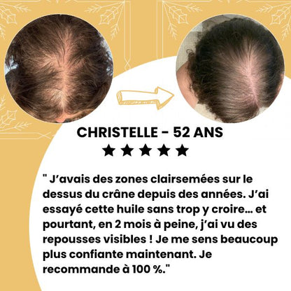 Huile de croissance pour cheveux