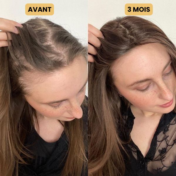 Huile de croissance pour cheveux
