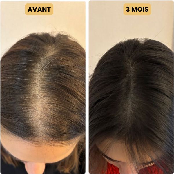 Huile de croissance pour cheveux